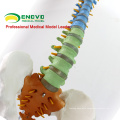 SPINE02 (12373) Medical Science Human Full Size Color Didactic Spine Model, Spine/Vertebrae Models